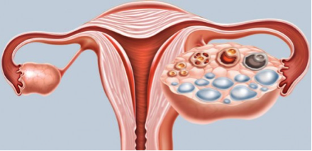 esquema-ovario-folicular